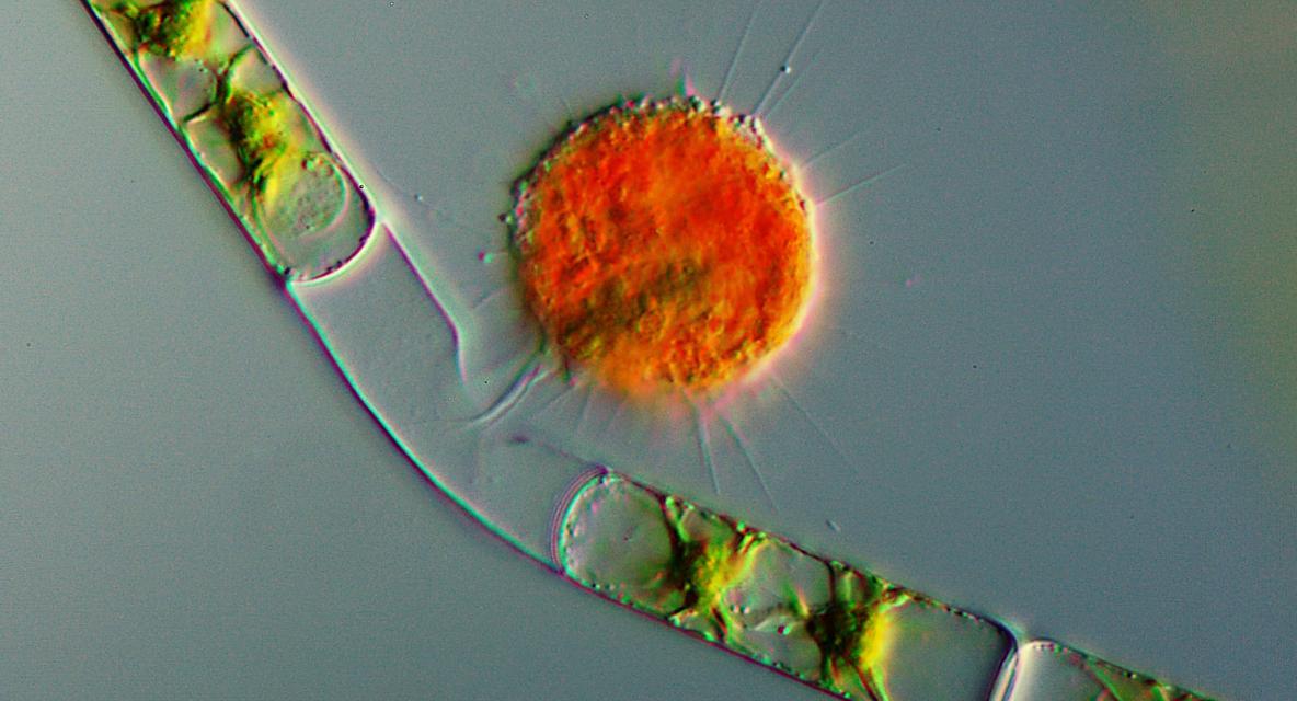 Представитель Семейства Vampyrellidae